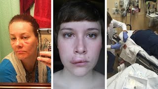 Getting worse Health care workers attacked by patients [upl. by Anaeirb]