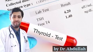 Thyroid Profile  Thyroid Test  Thyroid Function Test  TSH  T3 amp T4  How to read thyroid report [upl. by Sidalg]