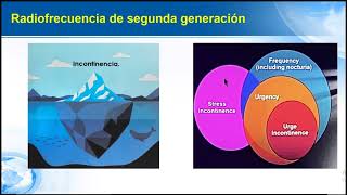 Radiofrecuencia de 2da Generación Avances en Uroginecología SC APUGyDSP 181124 [upl. by Joela]