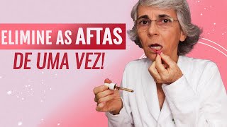 Causa das aftas [upl. by Nyral]