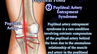 Anatomy Of The Popliteal Fossa  Everything You Need To Know  Dr Nabil Ebraheim [upl. by Reste]