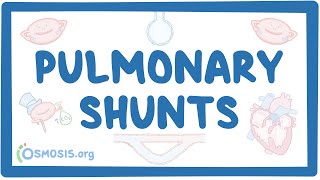 Pulmonary shunts [upl. by Aix]