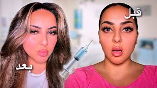 غيرت شكلي بالكامل 💉 تجميل كامل 🤩 بسمةداش [upl. by Litnahc794]