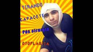 TIRANDO O CAPACETE PÓS CIRURGIA  PROJETO ORELHINHA [upl. by Eleen]