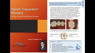 99 Seconds Tips  Outline Planning  Class II Amalgam Preparation [upl. by Moody]