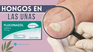 FLUCONAZOL para Hongos en las Uñas  Composición  Presentación  Dosis  Contraiindicaciones [upl. by Sremlahc]