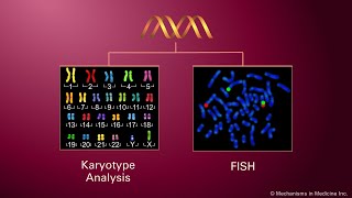 Genetic Predispositions for Multiple Myeloma [upl. by Eselrahc]