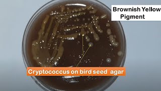 Bird seed agar Introduction and colonies characteristics of Cryptococcus neoformans [upl. by Ieso]