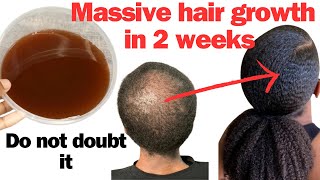 3 Important Ingredients That Can Grow Your Hair Long Thick and Bushy In a Short Time Nells Karimi [upl. by Llebpmac]