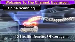 Benefits of using Ceragem Machine [upl. by Orva]