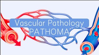 Vascular PATHOMA 3  Hypertension [upl. by Judah]