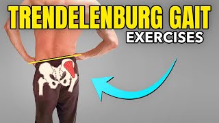 3 Exercises to Correct a Trendelenburg Gait Pattern [upl. by Htiel]