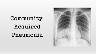 Community Acquired Pneumonia [upl. by Onibla]