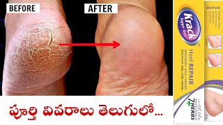 Krack Heel Repair Cream Uses in TeluguHow to Apply Krack CreamBest cream For Heals in Telugu [upl. by Matthiew]