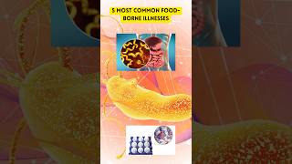 5 Most Common Foodborne Illnesses and Which Bacteria Cause Them [upl. by Ivah439]