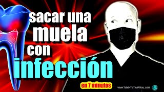 EXTRACCION de MUELA con INFECCIÓN [upl. by Brucie]