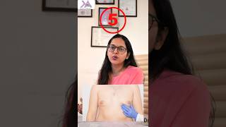 5 Facts Gynecomastia Surgery  Gyno Surgery के 5 जरूरी Facts manboobs chestfat yshort [upl. by Storz]