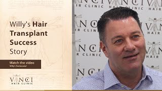 Willys hair transplant journey at Vinci Hair Clinic before amp after testimonial [upl. by Barb]