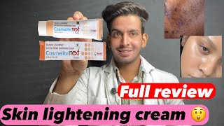 Cosmelite cream  Cosmelite cream ke fayde aur nuksan  Cosmelite cream review  cosmelite use [upl. by Meurer]