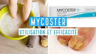 MYCOSTER Ciclopirox 1  8 [upl. by Kalina]