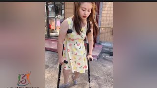 A disabled woman with polio walks on crutches polio [upl. by Armat]