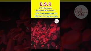 What is ESR test  Erythrocyte sedimentation rate test shorts ESR bloodtest [upl. by Aleafar]