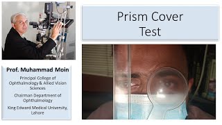 How to Perform Prism Cover Test [upl. by Oba307]