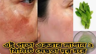 এই পাতা একবার লাগান চোখের পলকে মেছতা দূর হবে২ মিনিটে মেছতা দূর করার উপায়mesta dur korar upay [upl. by Wemolohtrab]