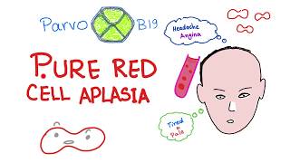 Pure Red Cell Aplasia PRCA  Parvo B19 Virus  Hematology [upl. by Airamesor]