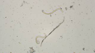 Parelaphostrongylus tenuis2 microscopic view [upl. by Boothman224]