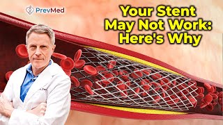 Your Stent May Not Work Heres Why [upl. by Leela]