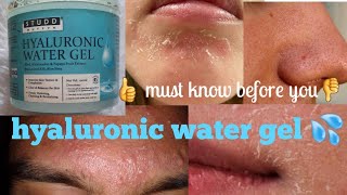 Hyaluronic water gel 💦 25 दिन use करने के बाद genuine reviewsStud muffin [upl. by Hepsoj]