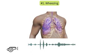 Abnormal lung sounds in COPD [upl. by Ennaecarg]