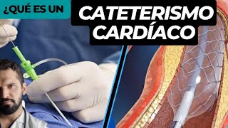 Que es un cateterismo cardiaco [upl. by Aztin]