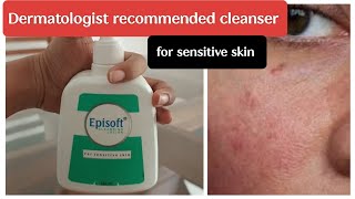 episoft cleansing lotion review in Tamil sensitiveskin [upl. by Taft]