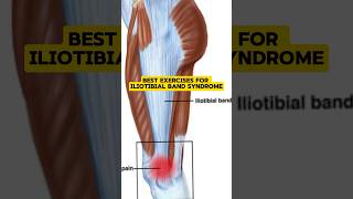 Best exercises for Iliotibial Band Syndromeleg painStrengthening of IT Bandleg by physiotherapy [upl. by Ayinat340]