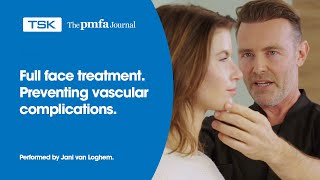 Full face injectable treatment by Jani van Loghem [upl. by Airdnal384]