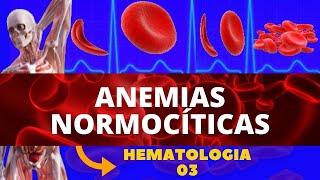 ANEMIAS NORMOCÍTICAS ANEMIAS  HEMATOLOGIA [upl. by Darraj471]