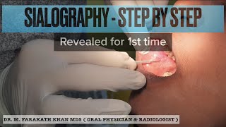 SIALOGRAPHY  Step by Step  Revealed for 1st time [upl. by Rufus]