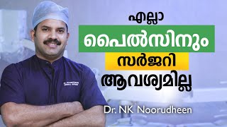 എല്ലാ പൈൽസിനും സർജറി ആവശ്യമില്ല  Piles Treatment Malayalam  Dr Noorudheen [upl. by Ettenaj325]