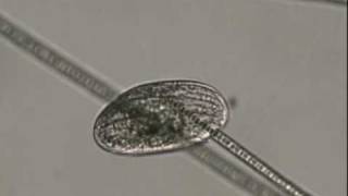 ciliate ingesting cyanobacteriam1v [upl. by Georglana]