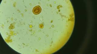 Huevo de Ascaris lumbricoides y quiste de Entamoeba coli en una muestra de heces [upl. by Enyale]