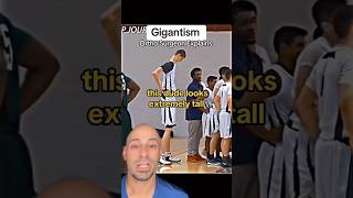 GIGANTISM  Doctor Explains shorts [upl. by Yenhoj]