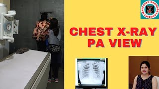 Xray Chest PA View l CXR PA VIEW I Anatomy l Patient Positioning l Radiography l Radiology l Xrays [upl. by Melisse]