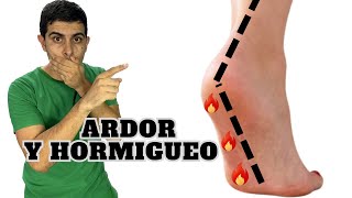 Neuropatía  Ardor y hormigueo en los pies [upl. by Leavelle923]