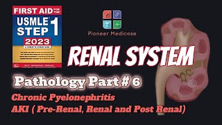 Acute Kidney Injury and Chronic Pyelonephritis for USMLE step 1pathology Part 6UrduHindi [upl. by Shere282]