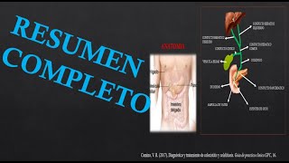 COLECISTITIS AGUDA [upl. by Oicul]