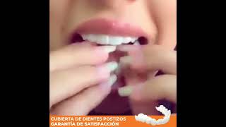 2 InstaSmile™ Cubierta de dientes postizos [upl. by Melesa]