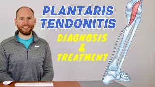 Plantaris Muscle Pain  Plantaris Rupture and Plantaris Tendonitis [upl. by Sorrows]