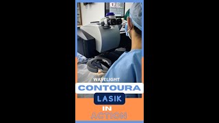 Wavelight Contoura Lasik In Action [upl. by Marjie31]